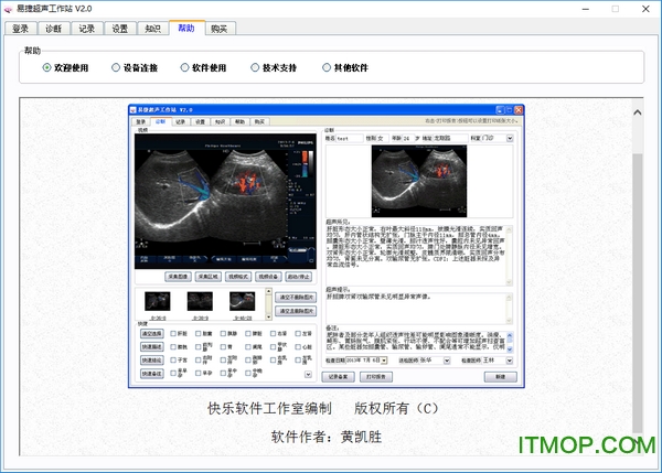 易捷超声工作站v2.0 绿色版