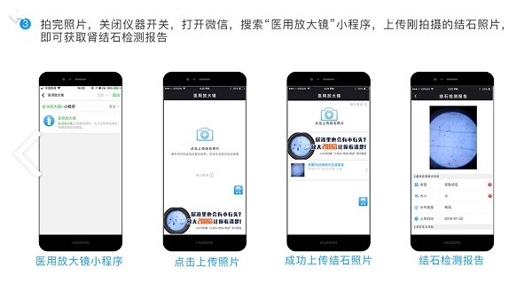 医用放大镜app手机版v1.0.15 安卓版