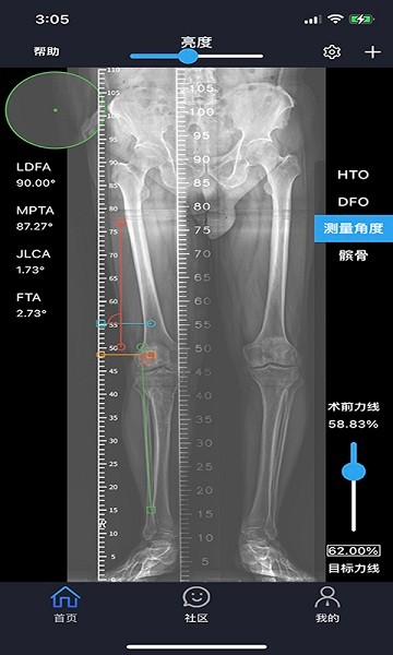 华保膝望app下载