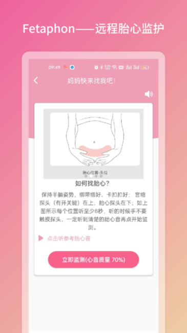 Fetaphon Home软件